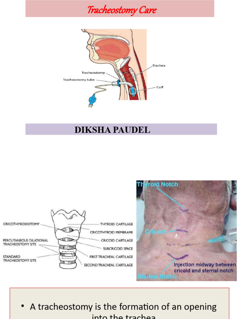 Tracheostomy Care: Essential Guidelines | PDF | Respiratory Tract | Larynx