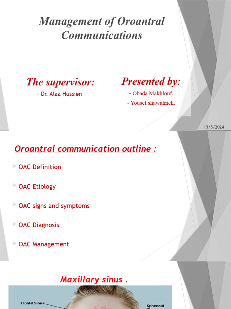 Oroantral Communication Management Guide | PDF | Clinical Medicine ...