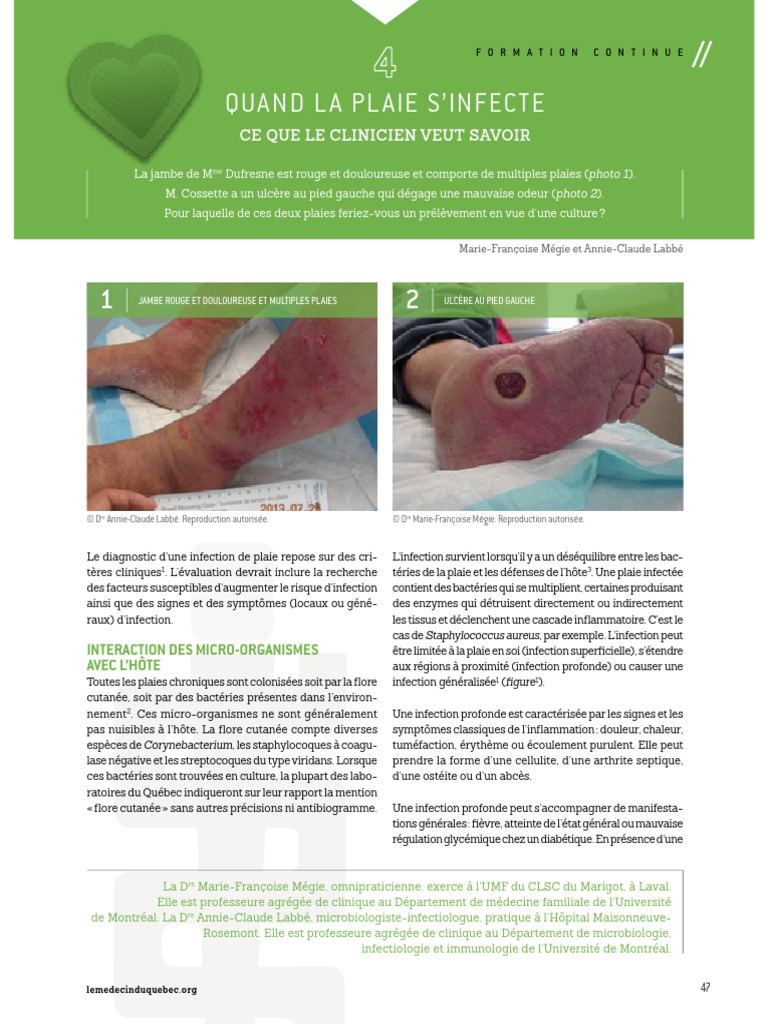 Gestion des plaies infectées en clinique | PDF | Sciences de la santé ...