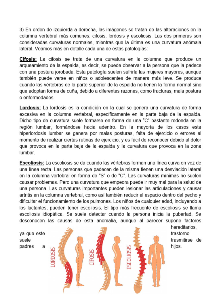 Curvaturas y Cuidado de la Columna | PDF | La columna vertebral ...