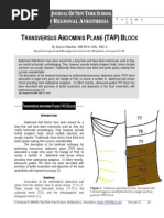 Download TRANSVERSUS ABDOMINIS PLANE TAP BLOCK by Suresh Kumar SN73870406 doc pdf
