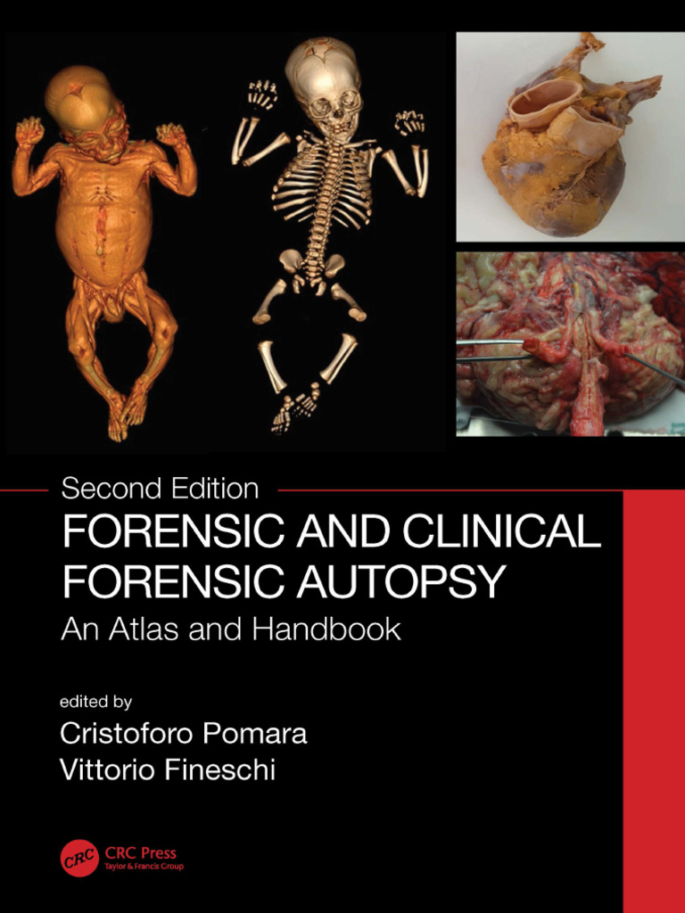 Copia20Cristoforo2C20Fineschi20Forensic20Clinical20Autopsy ...