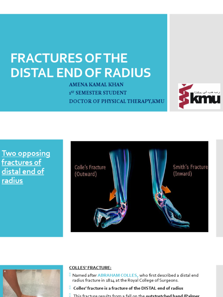 Distal Radial Fractures Pdf Skeletal System Musculoskeletal
