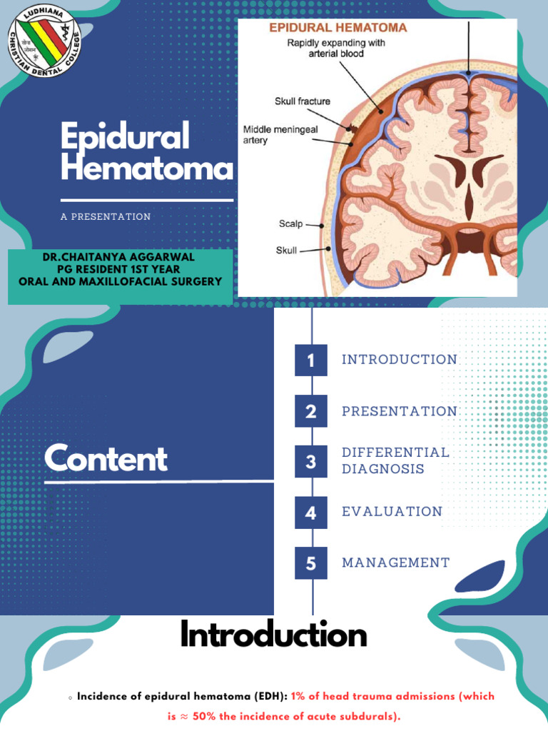 Epidural Hematoma | PDF | Injury | Human Head And Neck