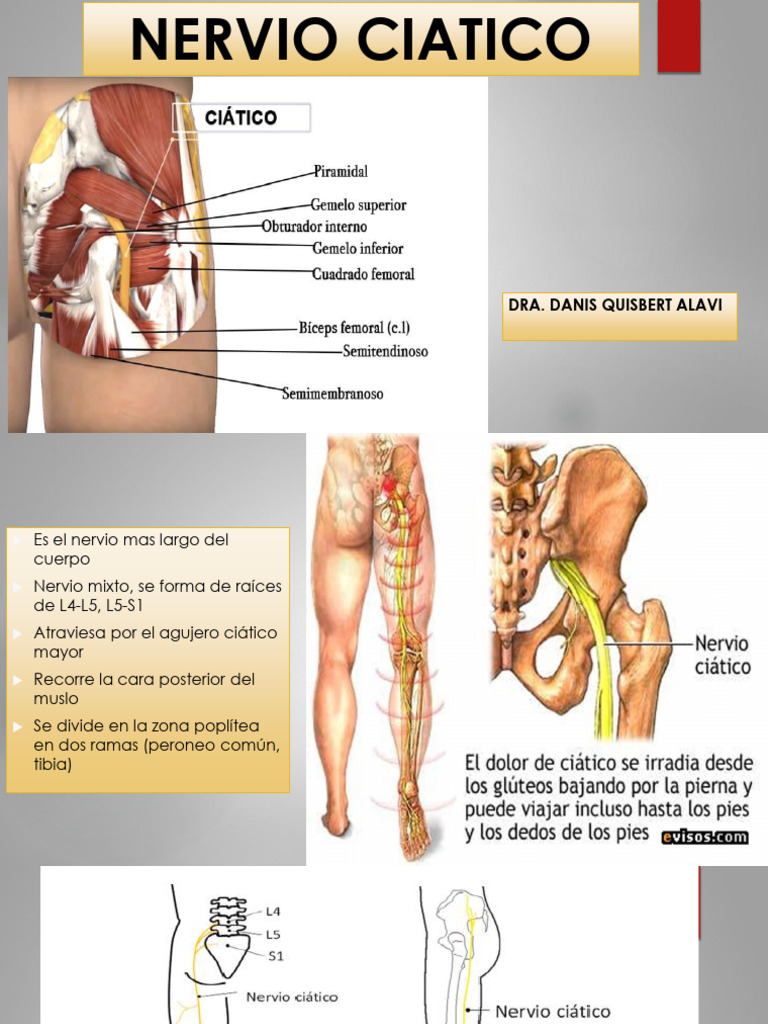 Nervio Ciatico Anatomia PDF Extremidades (anatomía) Tejido suave