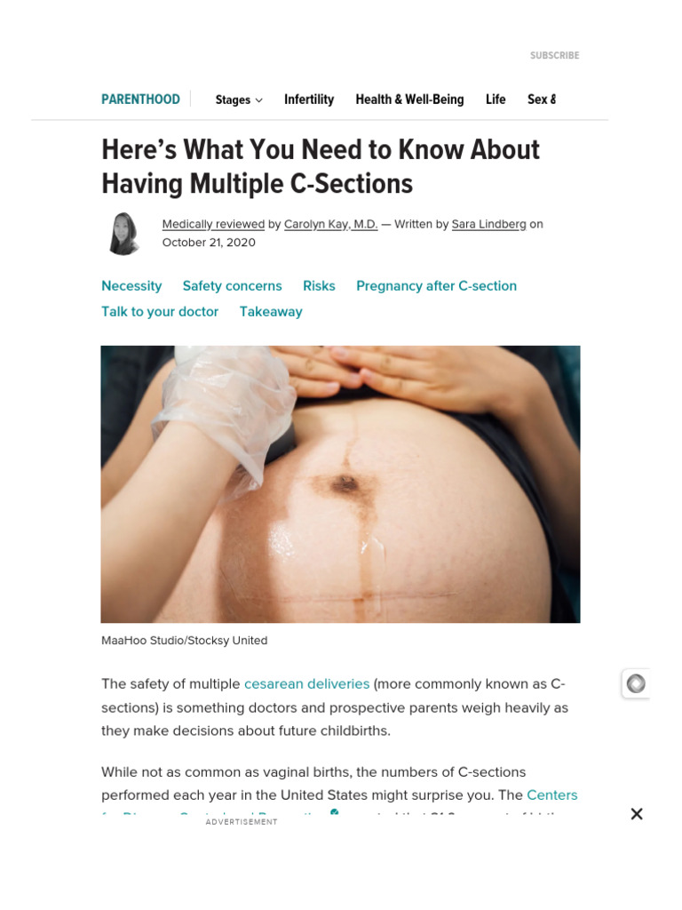 Safe Limits for Multiple C-Sections | PDF | Caesarean Section | Childbirth