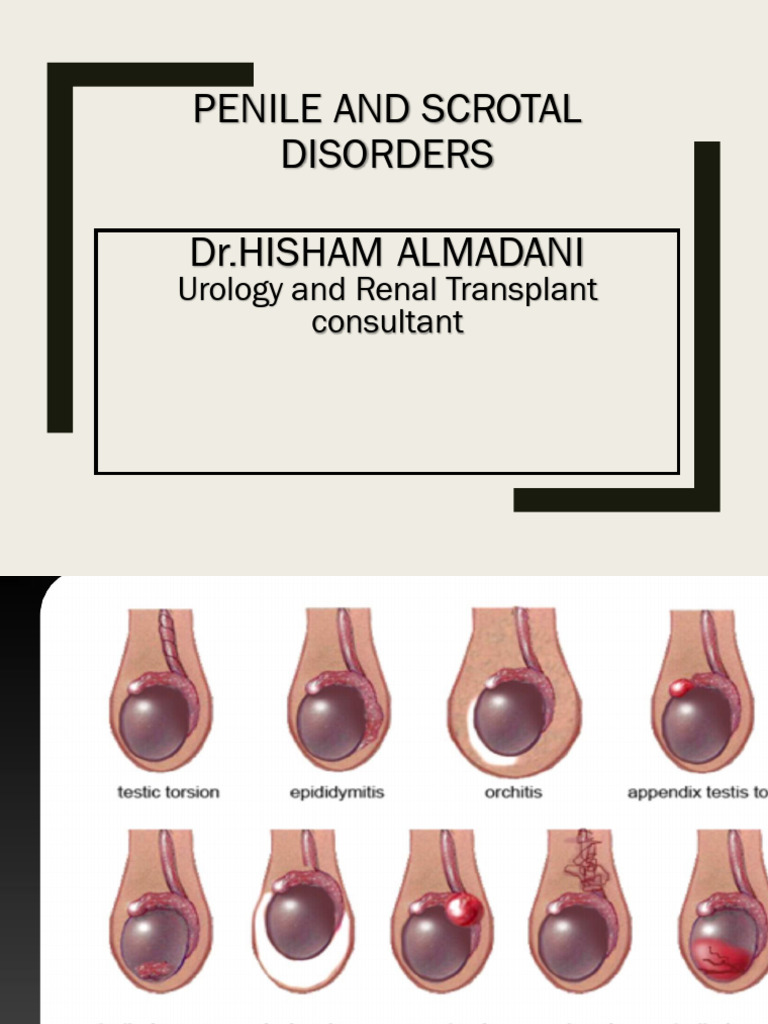 Lecture 5.07 - Penile and Scrotal Disorders | PDF | Erectile ...