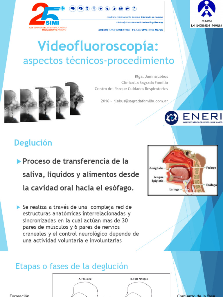 Videofluoroscopía de la Deglución: Procedimiento | PDF | Anatomía