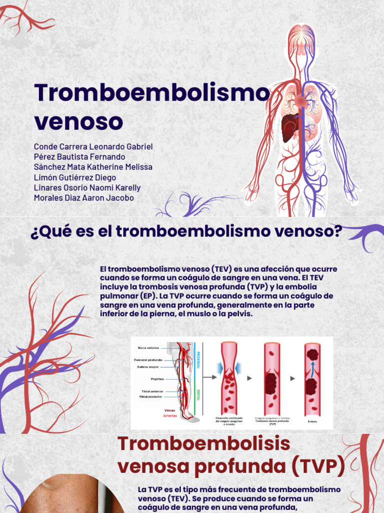 Guía sobre Tromboembolismo Venoso (TEV) | PDF | Trombosis | Embolia