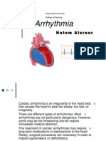 Cardiac Arrhythmia Causes