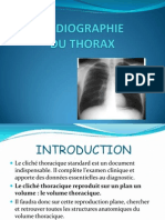 TD Radio Thorax Normale