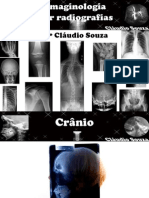 Aula 6 Imaginologia Por Radiografias Cranio Face - Prof Claudio Souza