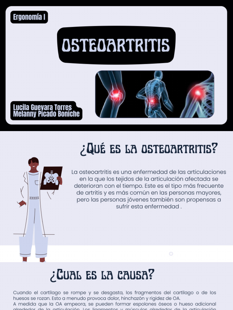Osteo Art Ritis | PDF
