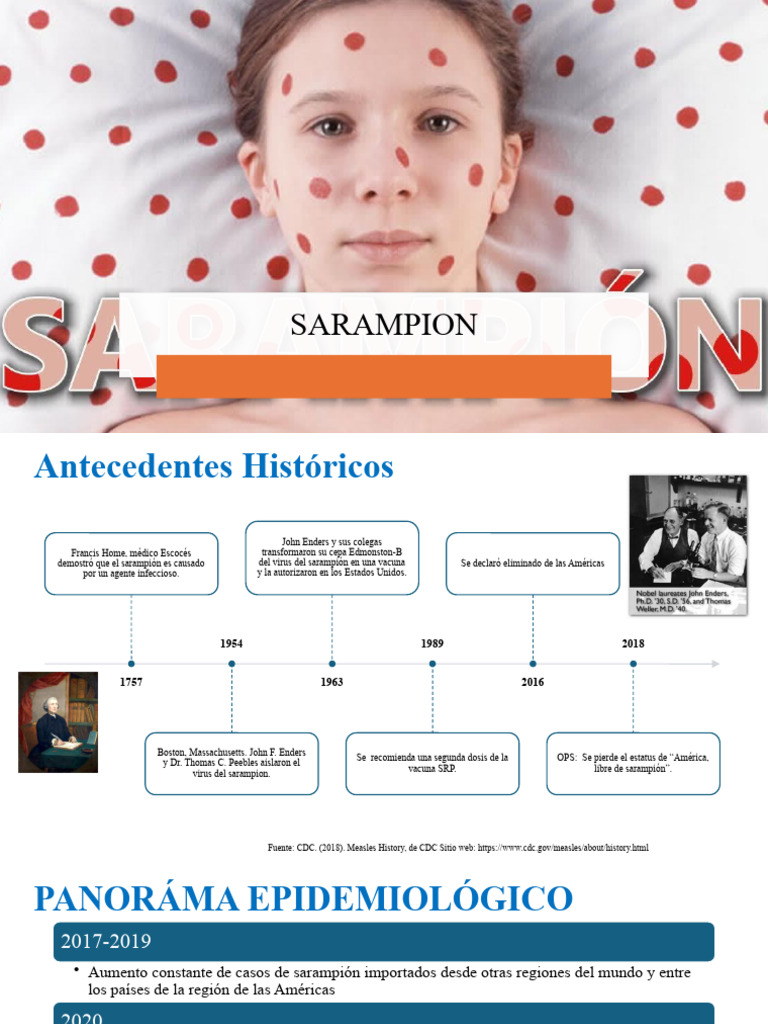Sarampion Panorama Epi Descargar Gratis Pdf Sarampión