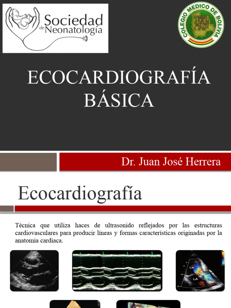 ecocardiografia-basica-pdf-ecocardiograf-a-coraz-n
