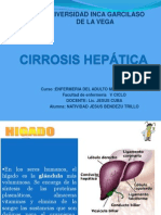 Cirrosis ..