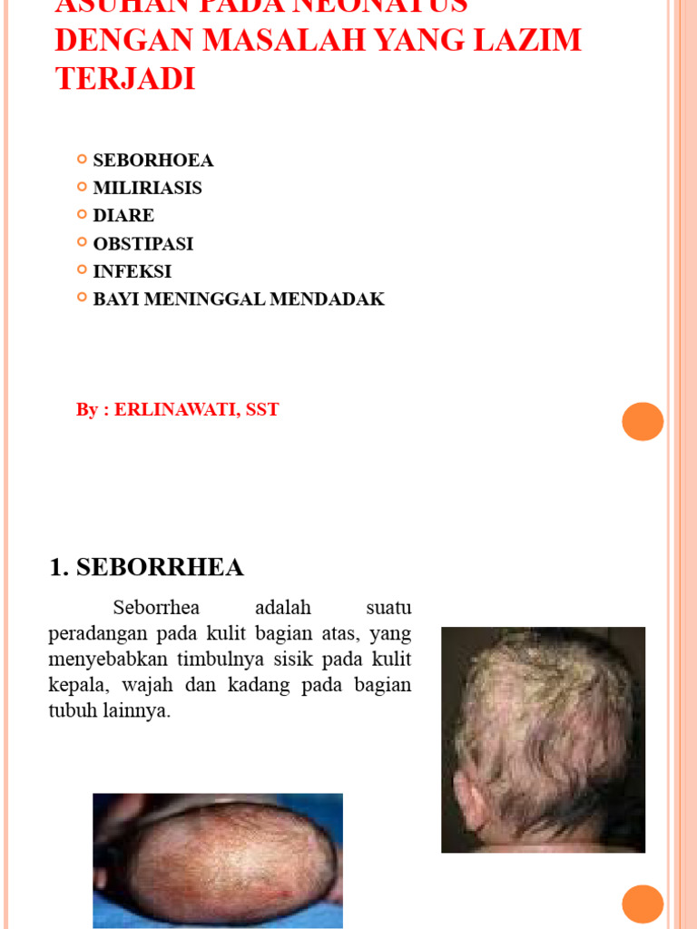 Kuliah 9 Maslah Lazim Neonatus | PDF
