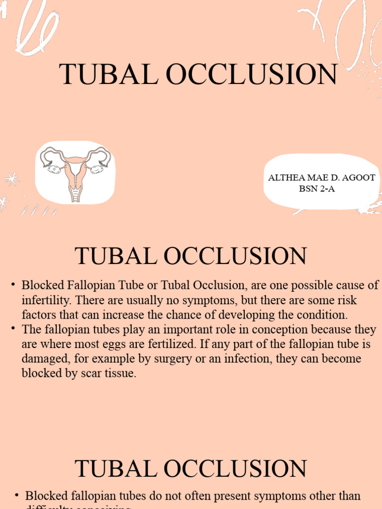 Understanding Tubal Occlusion | PDF