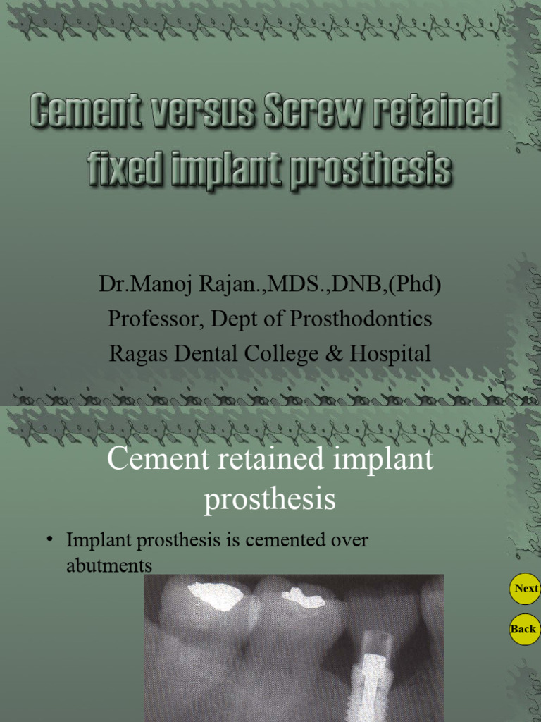cement versus screw retained implant prostheses Download Free PDF