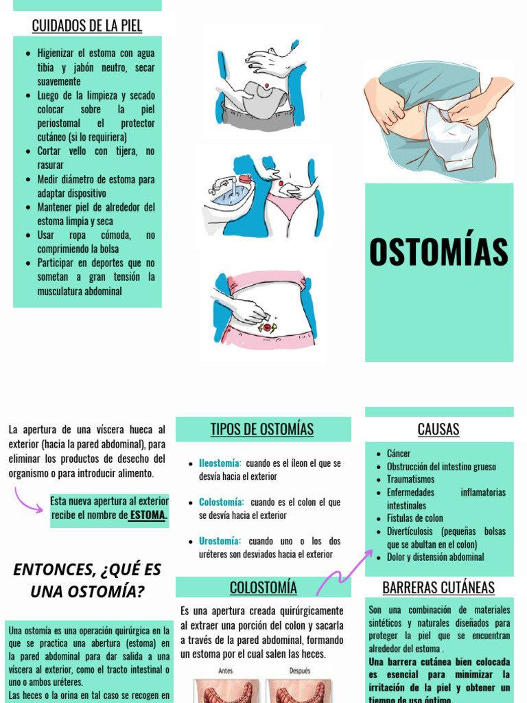 OSTOMIAS | PDF | Intestino grueso | Gastroenterología