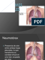 Sindromes Pleurales Adriian Diazz