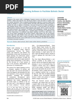 Cara smile Use of planning software to facilitate esthetic dental treatment in a case.