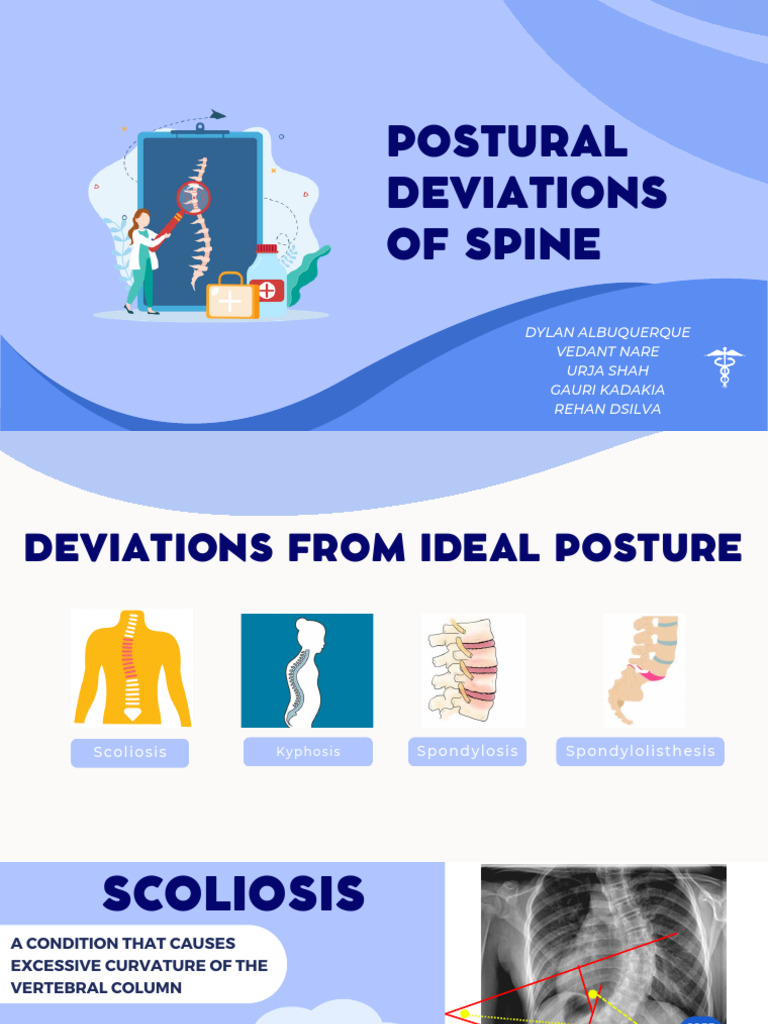 Posture PPT Updated | PDF | Vertebral Column | Scoliosis
