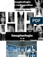 Aula 1 - Imaginologia por radiografias - mão-punho-antebraço-cotovelo. Profº Claudio Souza