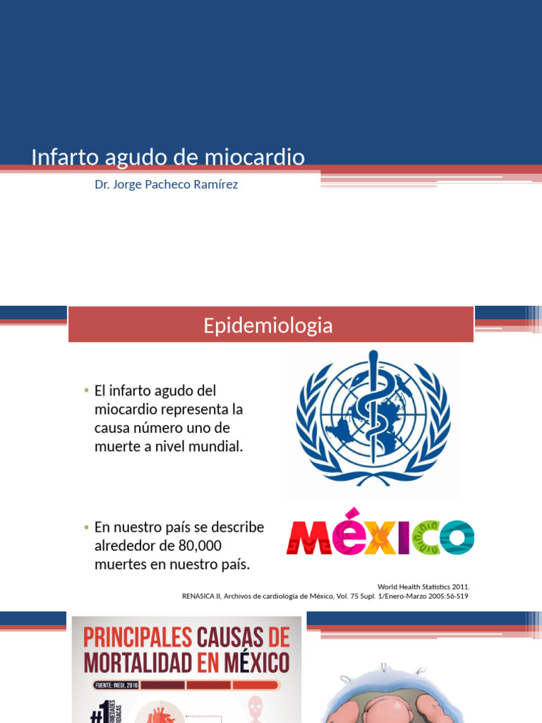 Infarto Agudo de Miocardio | PDF | Infarto de miocardio | Isquemia
