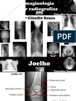Aula 3 imaginologia por radiografias- Perna e joelho. Profº Claudio Souza