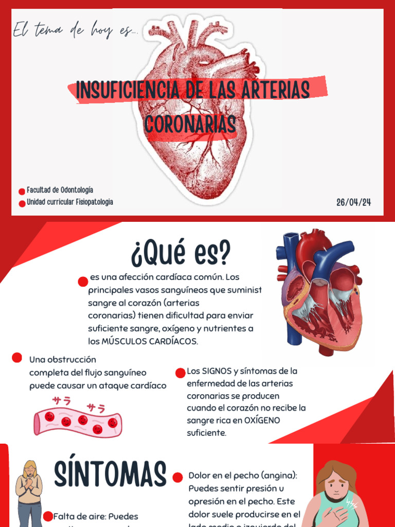 Insuficiencia de Arterias Coronarias: Causas y Síntomas | PDF | Infarto ...