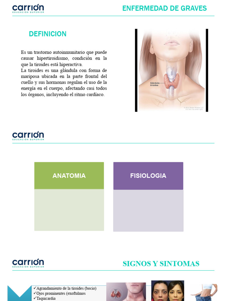 ENFERMEDAD DE GRAVES QUE ES visual data 2