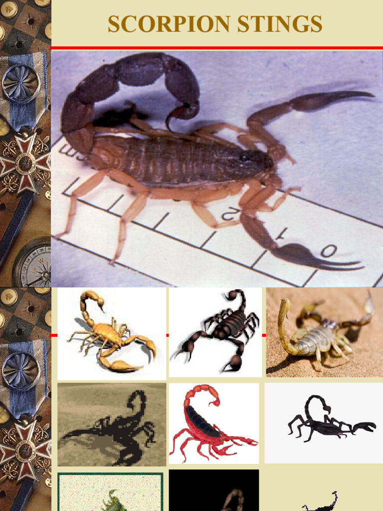 Image showcasing Stingray Sting - StatPearls - NCBI Bookshelf