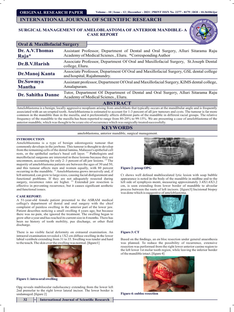 surgicalmanagementofameloblastomaofanteriormandibleacasereport