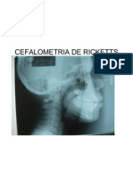 Cefalometria de Ricketts