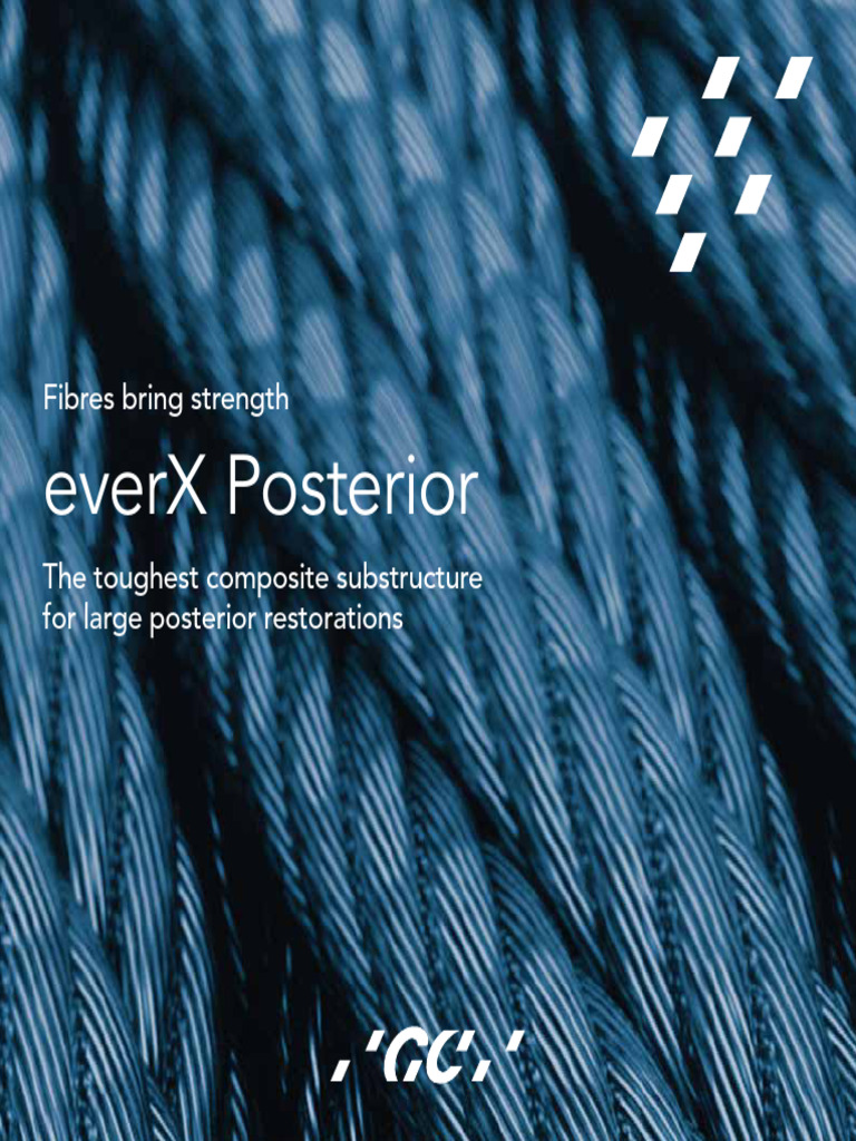 everX Posterior: Strength in Restorations | PDF | Dental Composite ...