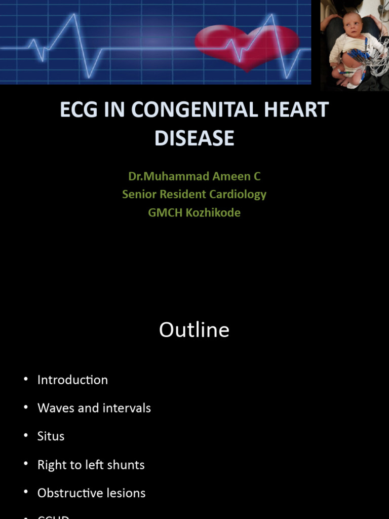 ECG Insights for Congenital Heart Disease | PDF | Electrocardiography ...