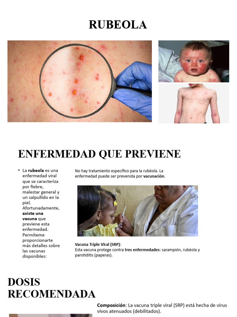 Prevención y Vacunación de Rubeola | PDF | Vacunas | Microbiología