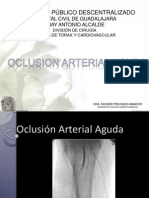 Oclusion Arterial Aguda