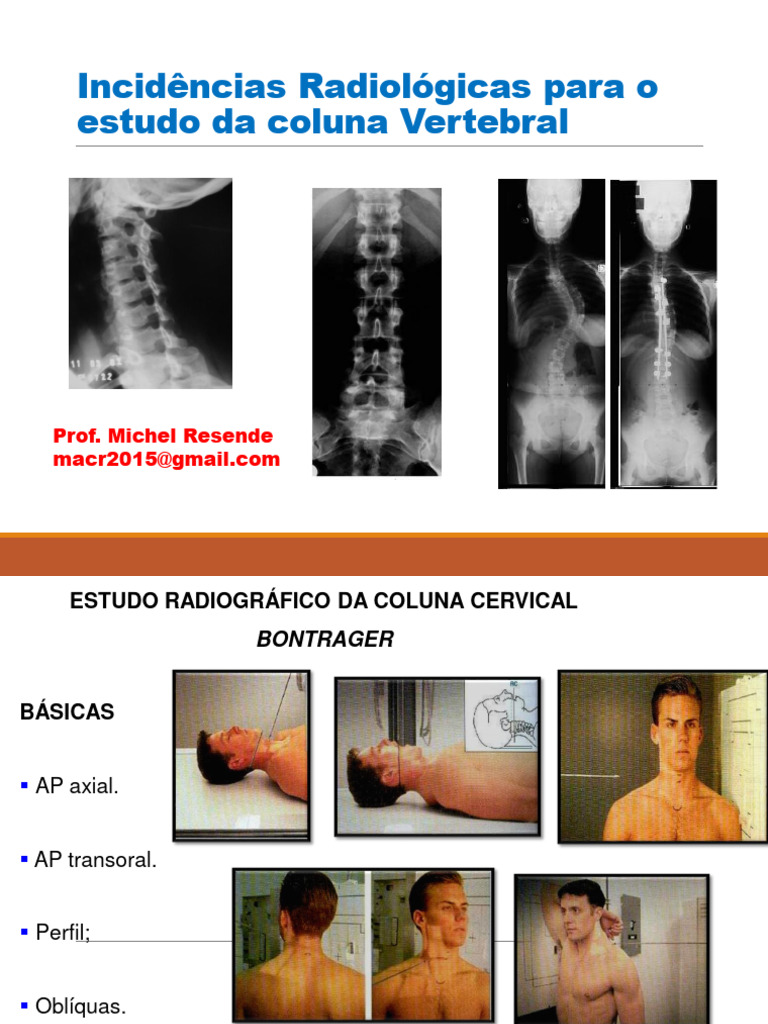 Incidências Radiológicas da Coluna Vertebral | PDF | Coluna vertebral |  Pélvis, image size:768x1024