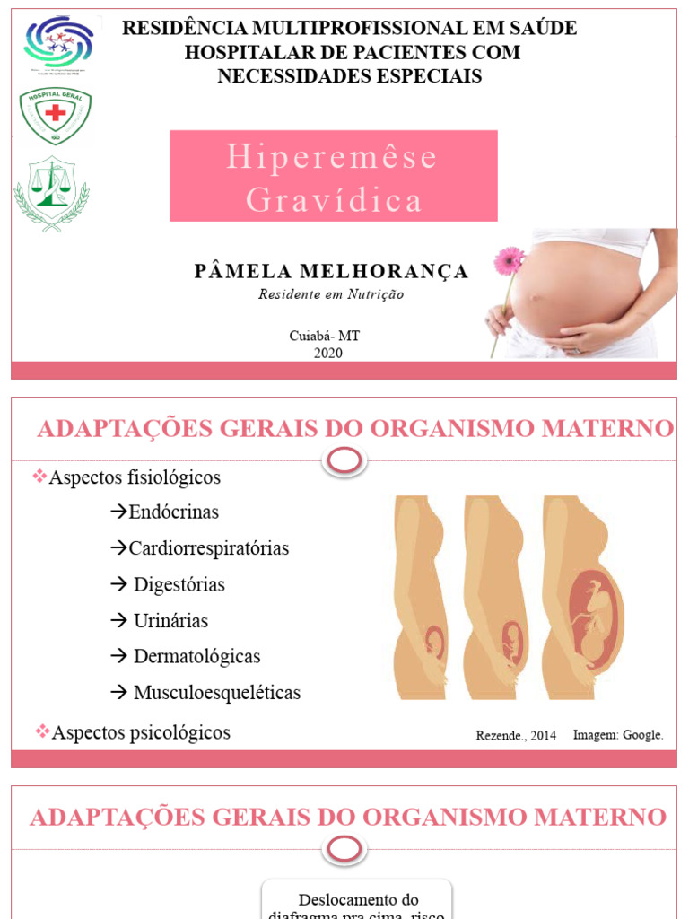 Hiperêmese Gravídica: Sintomas e Tratamento | PDF | Gravidez | Doenças ...