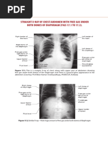Makhan Lal Saha Surgery - PDF 2