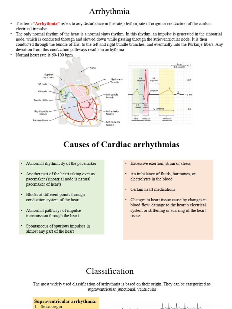 Arythmia | PDF | Heart | Heart Rate
