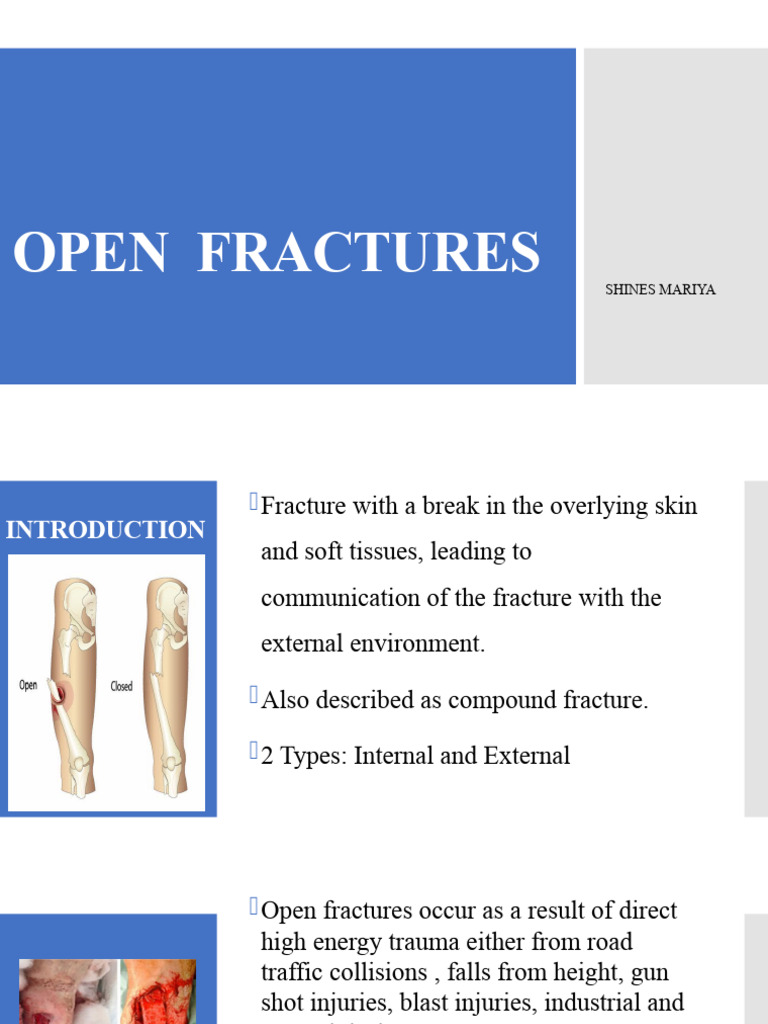 Open Fracture Management Guide | PDF | Amputation | Wound