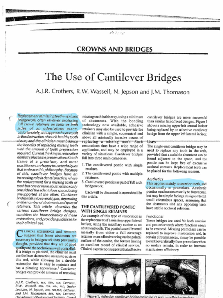 Crothers AJR, 1995 The Use of Cantilever Bridges. | PDF