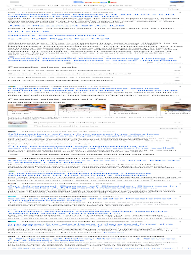 Can Iud Cause Kidney Stones Google Search PDF Birth Control