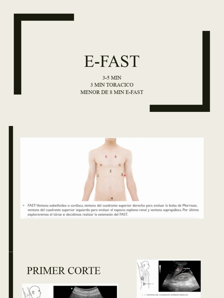 E Fast | PDF