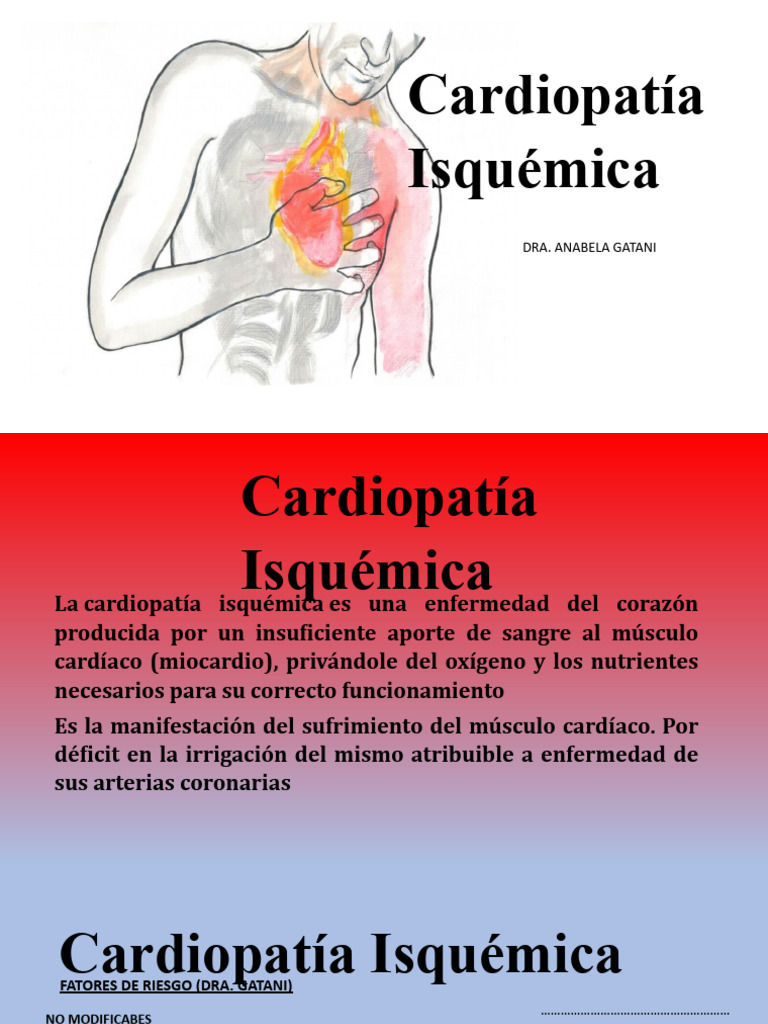 Angor Iam | PDF | Infarto de miocardio | Corazón