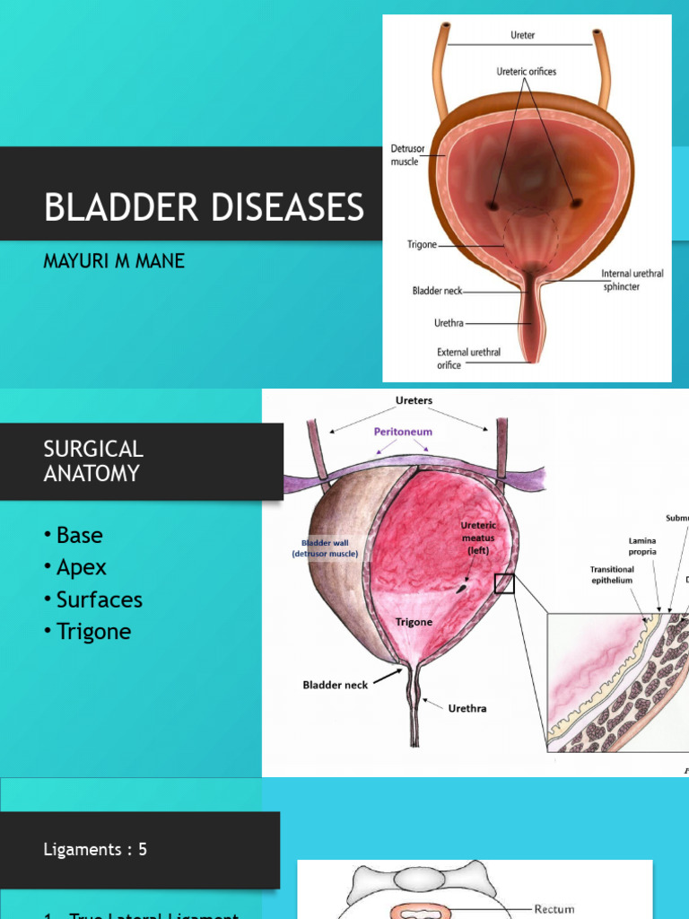 Bladder Diseases: Anatomy and Conditions | PDF | Metastasis | Carcinoma