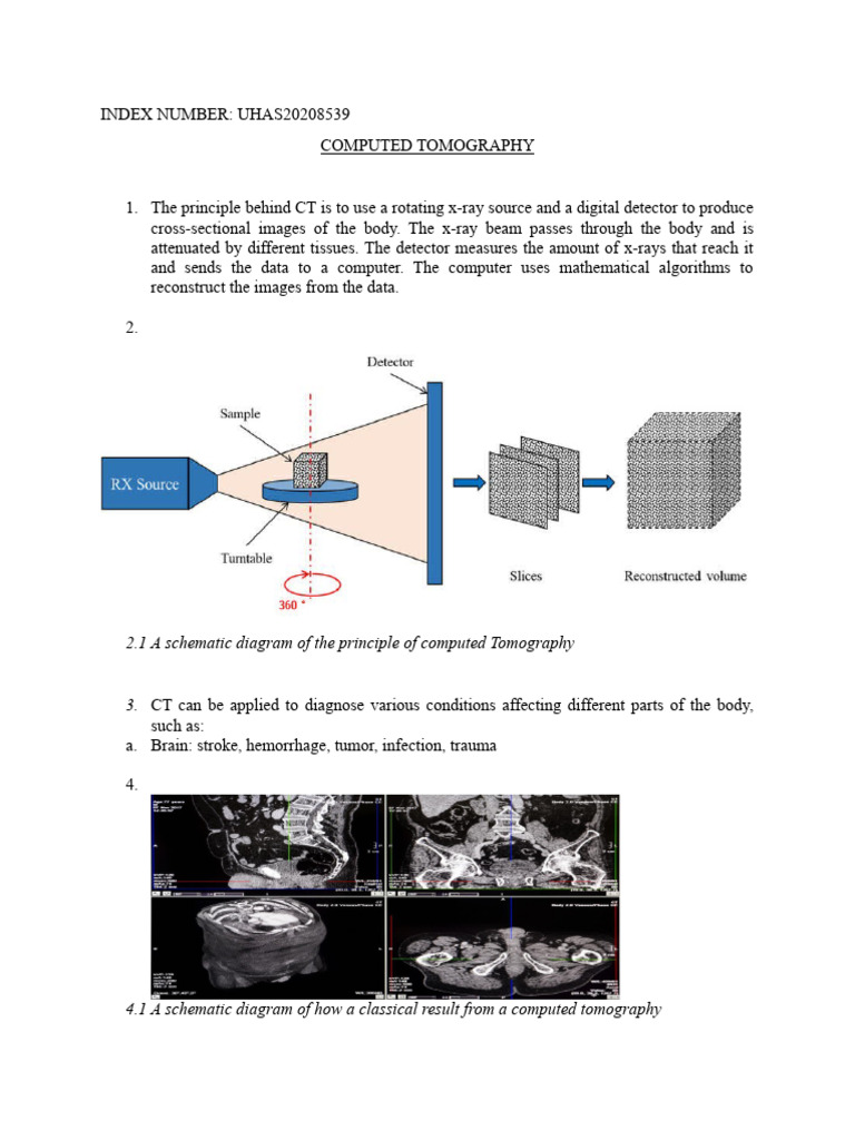 Understanding Computed Tomography (CT) | PDF | Ct Scan | X Ray